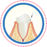 gingival measuring